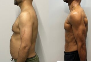 How to Reduce Weight in 15 Days