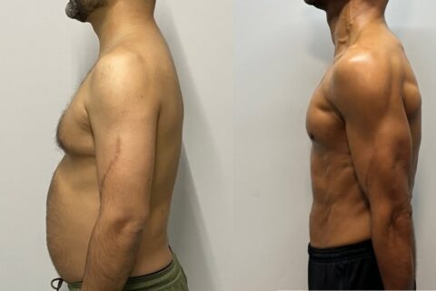 How to Reduce Weight in 15 Days